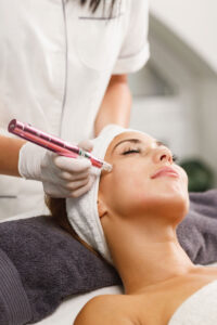 dermapen facial