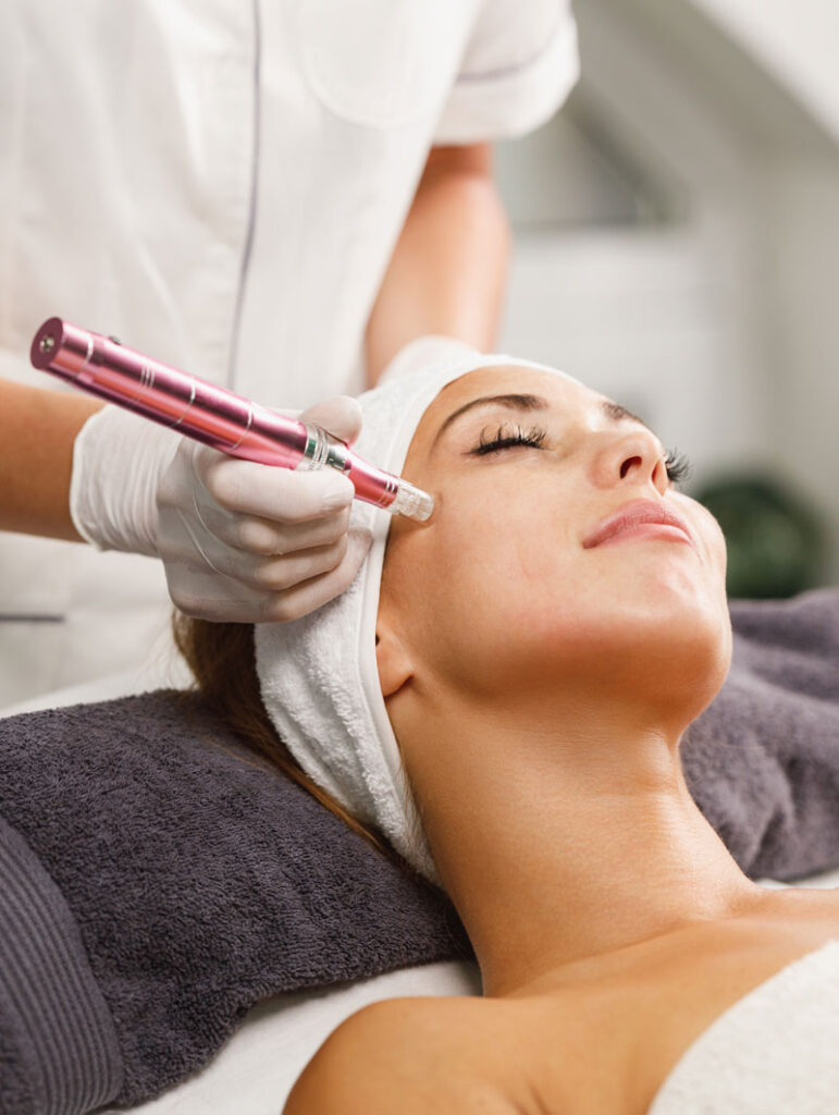dermapen facial